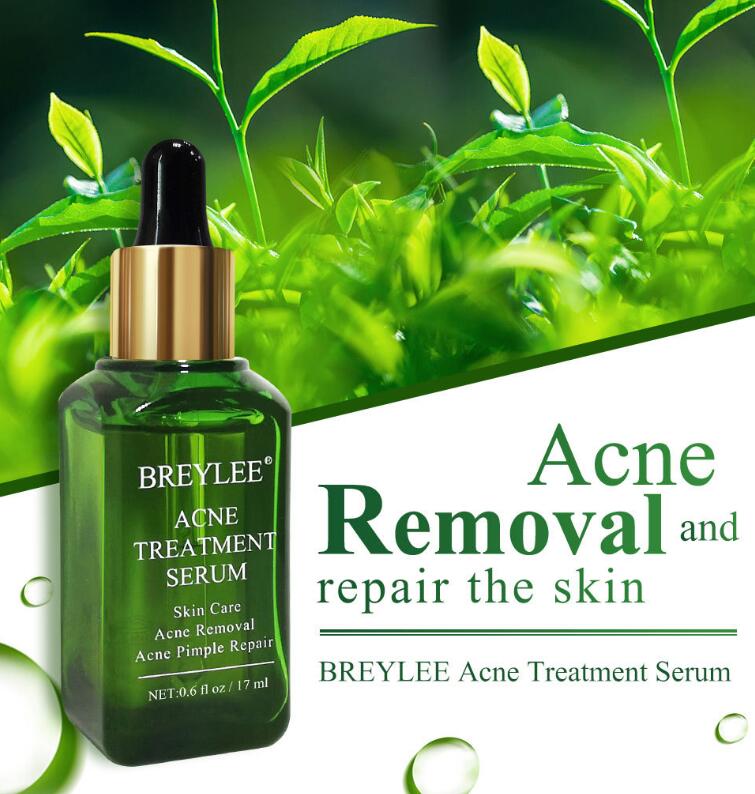 Acne Treatment Serum Facial Essence Repair Oil