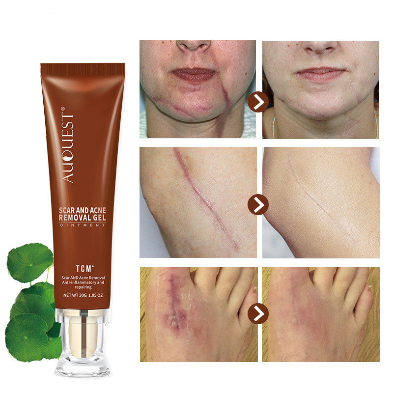 Moisturizing Scar Repair Skin Care Gel