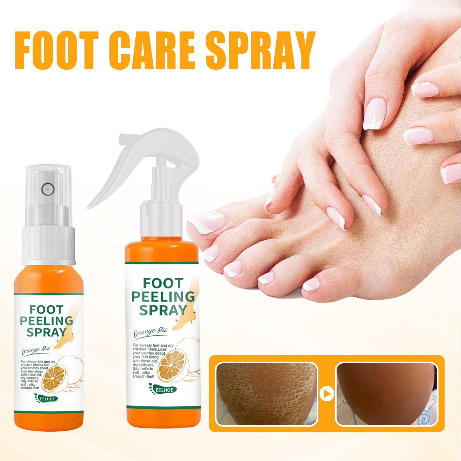 Exfoliate Feet Remove Dead Skin And Calluses Heel Elbow And Knee Care Spray