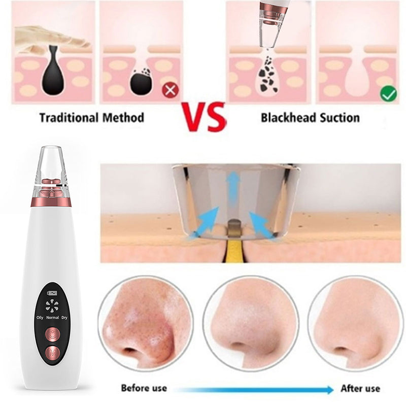 Microcrystalline Blackhead Remover Pore Vacuum Cleaner with Multiple Suction Probes for all skin types